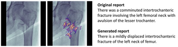 Figure 1, Human-Language And Heat-Map Explanations